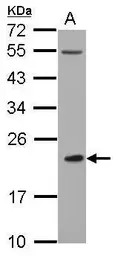CLEC4A antibody