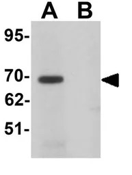 LRRTM1 antibody