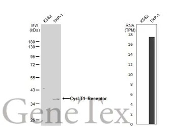 CysLT1 Receptor antibody [N1],