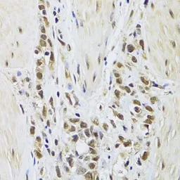 Splicing Factor 1 antibody
