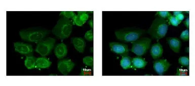 HAUS2 antibody [N1C3-2]