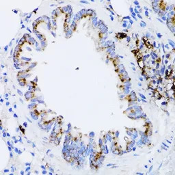 Retinoic Acid Receptor alpha a