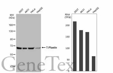 T-Plastin antibody