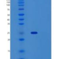 人Sentrin特异性蛋白酶2/SENP2重组蛋白N-6His, SUMO tag