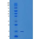 人CDK2AP2重组蛋白C-6His产品图