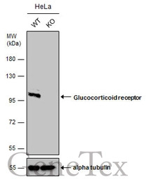 Glucocorticoid Receptor antibo