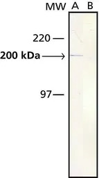 Myosin skeletal slow antibody 