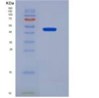 人突触核蛋白γ(SNCG)重组蛋白