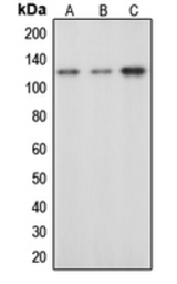 CBL (phospho Tyr674) antibody