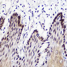 Transketolase antibody