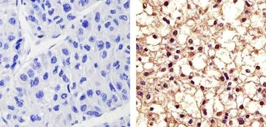 PYK2 (phospho Tyr402) antibody