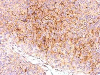 CXCR5 antibody [C1C2], Interna