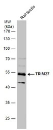 TRIM27 antibody