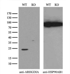 Rho GDI alpha antibody [1F2]