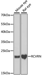 Recoverin antibody