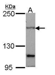 PTCH1 antibody