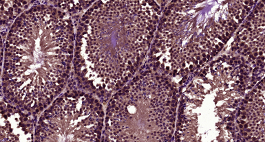 LBX1 antibody