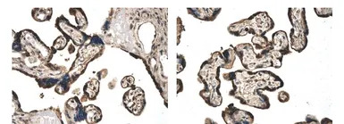 Activin Receptor Type IIB anti