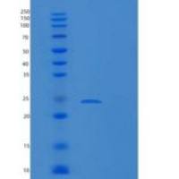 人铁蛋白轻链重组蛋白