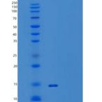 人甲状腺素运载蛋白/TTR/PALB重组蛋白C-6His