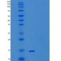 人甲状腺素运载蛋白/TTR/PALB重组蛋白C-6His