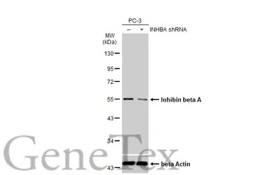 Inhibin beta A antibody