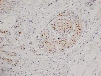 Progesterone Receptor antibody