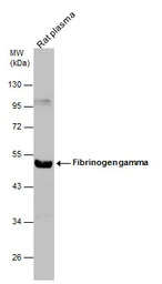 Fibrinogen gamma antibody