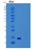 人β-神经生长因子/β-NGF重组蛋白Ser122-Arg2