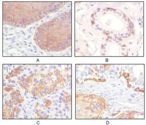 Cytokeratin 5 antibody [3E2F1]