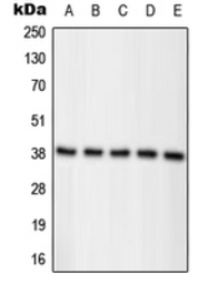 Nucleophosmin (phospho Thr234)