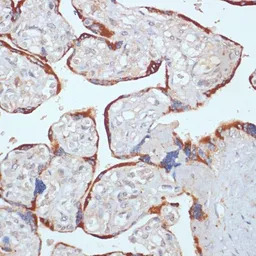 PDGF Receptor beta antibody