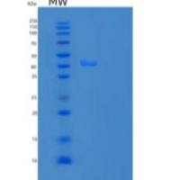 人血小板受体Gi24/VISTA/B7-H5/PD-1H重组蛋白C-Fc