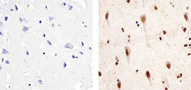 PYK2 (phospho Tyr402) antibody