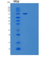 人β-半乳糖苷酶/GLB1重组蛋白C-6His