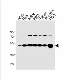 Calreticulin antibody, Interna
