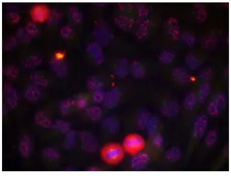 ELK1 (phospho Thr417) antibody