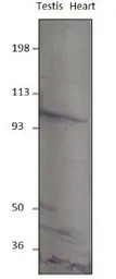 PDE8B antibody