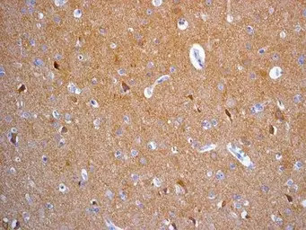 TrkA antibody [EPR1104(2)]