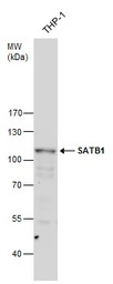 SATB1 antibody