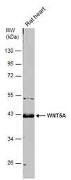 Wnt5a antibody