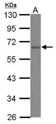hnRNP K antibody