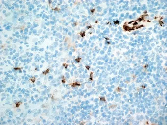 CD11b antibody [ICRF44]