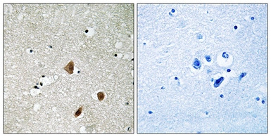 PAK3 (phospho Ser154) antibody