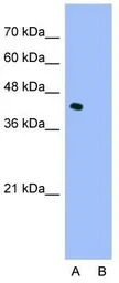 ILF2 antibody, C-term