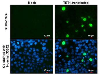 TET1 antibody [GT465]
