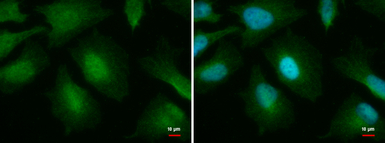 O-GlcNAc transferase antibody 