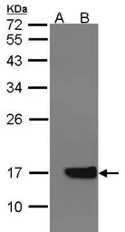 Cytochrome b5 antibody [N1C3]
