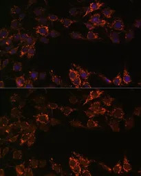 Monoamine Oxidase A antibody