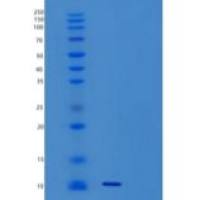 人小泛素相关修饰因子3/SUMO3/SMT3A重组蛋白